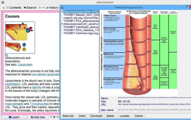 SuperMemo: Download images dialog box makes it possible for you to get images embedded in local pages imported from the net and put them to the image registry (in the picture: A Wikipedia article on atherosclerosis)